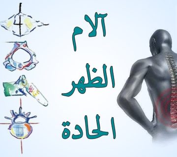 آلام الظهر المزمنة حلول علاجية مبتكرة مع العلاج الطبيعي