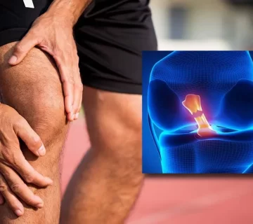 أفضل تمارين العلاج الطبيعي بعد تمزق الأربطة