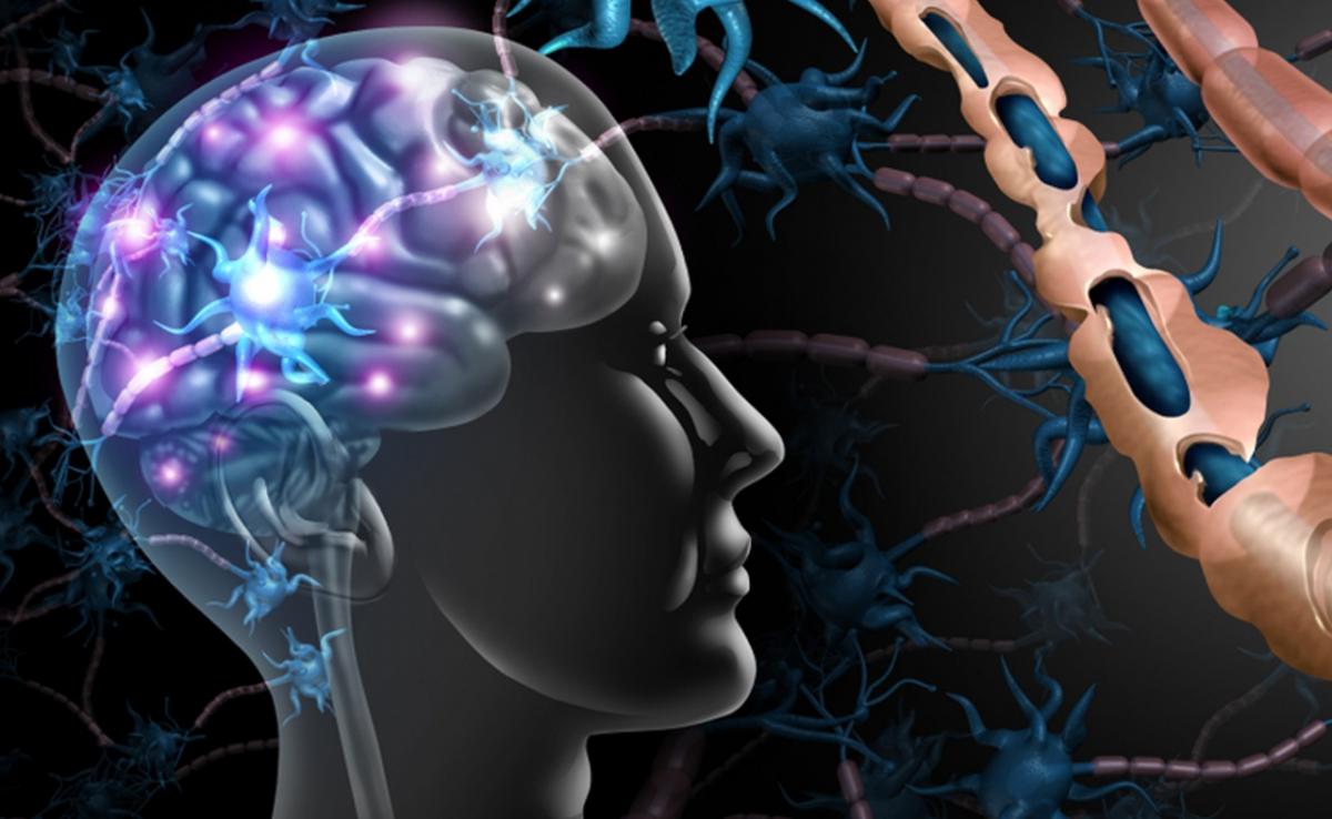 تمارين العلاج الطبيعي لمرضى التصلب المتعدد واستعادة التوازن والحركة 1 تمارين العلاج الطبيعي لمرضى التصلب المتعدد واستعادة التوازن والحركة